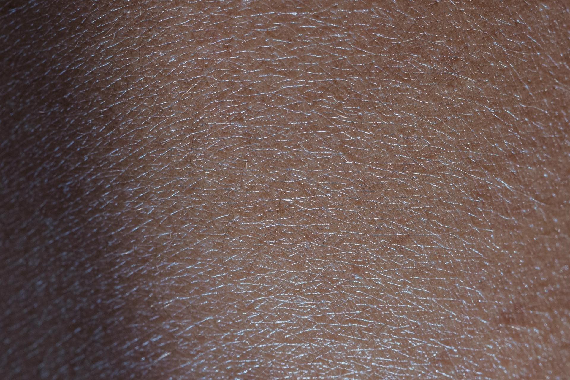 Very Dry Skin | Deep Hydration & Nourishing Skincare